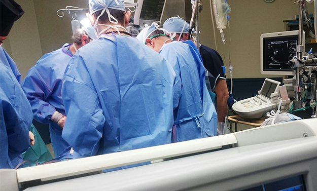 الملامح الرئيسية ل CAK كبازات بالمنظار