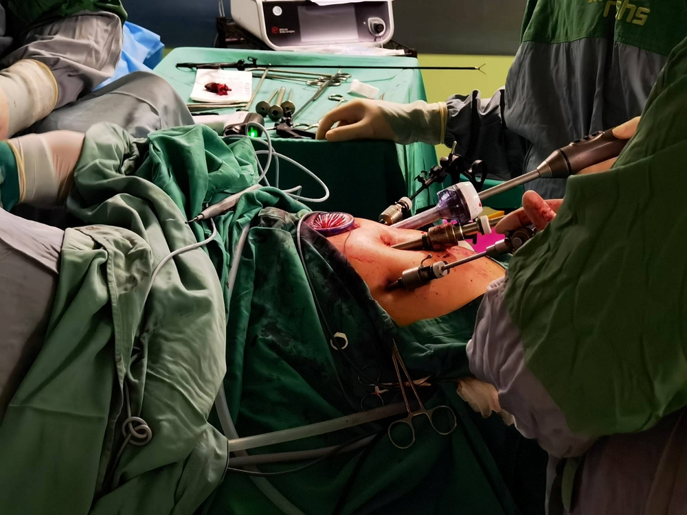 CAK Medical Device in the Operating Room