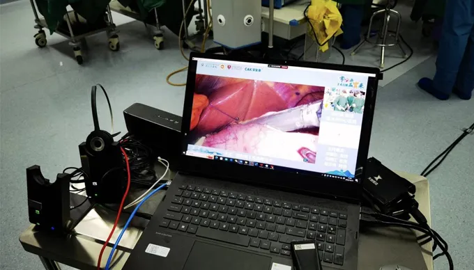 CAK الدبابيس الجراحية تتألق في ست عمليات جراحية حية في جميع أنحاء الصين